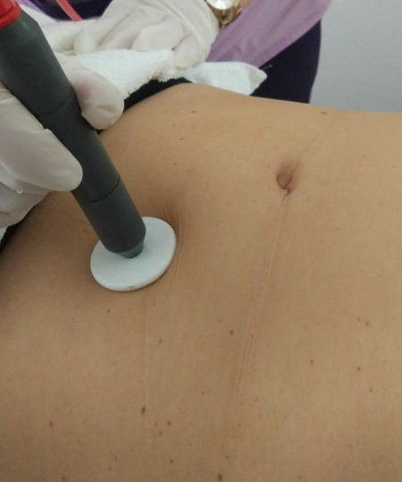 IMG_20170330_134909 IMG_20170330_134909